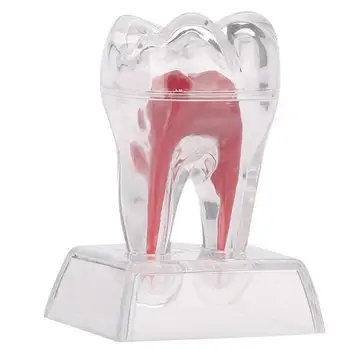 Dantų Anatomijos Modelis Skaidrus, Nuimamas Vieno Danties Irimas Modelis Odontologijos Klinika Papuošalų Mokymo